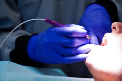 LANAP 101: A Modern Solution for Treating Gum Disease – Fisher Periodontics